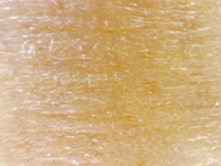 マイクロバブル浴ありの肌の状態（毎日入浴・5週間）